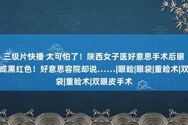 三级片快播 太可怕了！陕西女子医好意思手术后眼睛充血变成黑红色！好意思容院却说……|眼睑|眼袋|重睑术|双眼皮手术